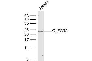 Mouse spleen lysates probed with Rabbit Anti-CLEC5A Polyclonal Antibody, Unconjugated  at 1:500 for 90 min at 37˚C.