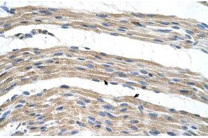 Immunohistochemistry (IHC) image for anti-Solute Carrier Family 17 (Anion/Sugar Transporter), Member 4 (SLC17A4) (Middle Region) antibody (ABIN2781622)