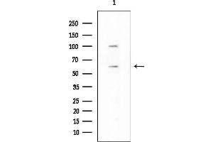 anti-Seryl-tRNA Synthetase (SARS) antibody