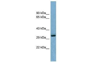 OTUD6B antibody used at 1 ug/ml to detect target protein. (OTUD6B Antikörper  (Middle Region))
