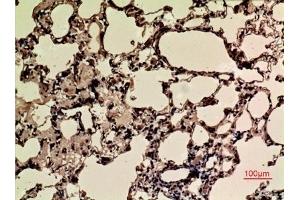 Immunohistochemical analysis of paraffin-embedded rat-lung, antibody was diluted at 1:100. (NRF2 Antikörper  (acLys599))