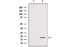 Western blot analysis of extracts from 293, using SKP1 Antibody. (SKP1 Antikörper  (Internal Region))