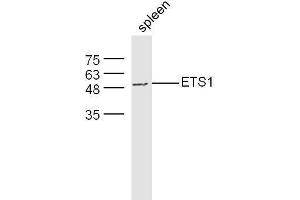 Mouse spleen lysates probed with Rabbit Anti-ETS1 Polyclonal Antibody, Unconjugated  at 1:500 for 90 min at 37˚C. (ETS1 Antikörper  (AA 321-441))