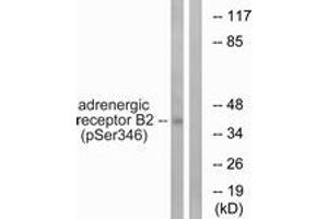 Western blot analysis of extracts from HepG2 cells treated with nocodazole 1ug/ml 16h, using Adrenergic Receptor beta2 (Phospho-Ser346) Antibody. (beta 2 Adrenergic Receptor Antikörper  (pSer346))