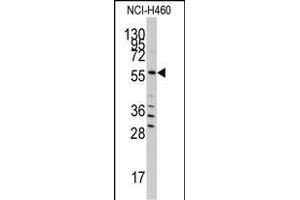 Western blot analysis of anti-SARS Antibody (C-term) (ABIN392296 and ABIN2841952) in NCI- cell line lysates (35 μg/lane). (Seryl-tRNA Synthetase (SARS) (AA 394-422), (C-Term) Antikörper)