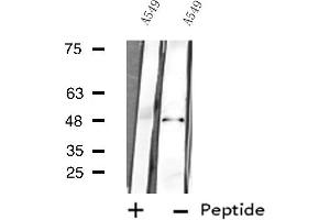 Western blot analysis of extracts from A549 cells using MAPK9 antibody. (JNK2 Antikörper  (N-Term))