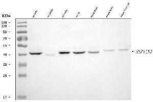 Western blot analysis of Septin 2/SEPTIN2 using anti-Septin 2/SEPTIN2 antibody (ABIN7599275). (Septin 2 Antikörper  (AA 1-326))