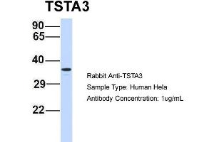 Host: Rabbit Target Name: TSTA3 Sample Type: Hela Antibody Dilution: 1. (TSTA3 Antikörper  (N-Term))