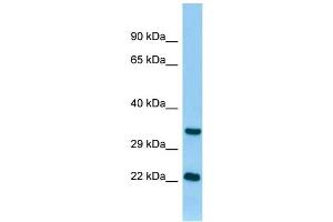 WB Suggested Anti-Tnni3 Antibody Titration: 1. (TNNI3 Antikörper  (N-Term))