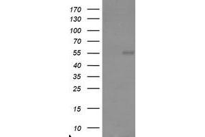 Image no. 1 for anti-TRAF Interacting Protein (TRAIP) (AA 67-313) antibody (ABIN1491631)