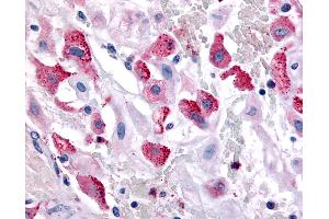 Anti-BRS3 antibody IHC of human uterus, pregnant. (BRS3 Antikörper  (Cytoplasmic Domain))