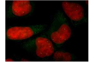 Image no. 2 for anti-Survival of Motor Neuron 1, Telomeric (SMN1) antibody (ABIN108567) (SMN1 Antikörper)
