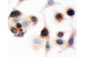 Anti-Bid Picoband antibody,  ICC: A549 Cell