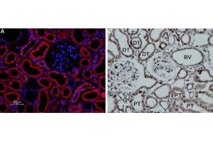 Expression of TRPP1 (PKD2) in rat kidneyImmunohistochemical staining of rat kidney paraffin embedded sections using Anti-TRPP1 (PKD2) Antibody (ABIN7581944), (1:100), followed by goat anti-rabbit-Alexa-Fluor-594 secondary antibody.