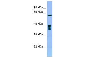 WB Suggested Anti-SLC22A5 Antibody Titration: 1. (SLC22A5 Antikörper  (C-Term))