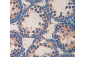Used in DAB staining on fromalin fixed paraffin- embedded testis tissue (MAST2 Antikörper  (AA 512-785))