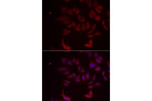 Immunofluorescence analysis of MCF-7 cells using RPL11 antibody. (RPL11 Antikörper)