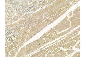 ABIN6262082 and ABIN6276562 at 1/100 staining human tongue carcinoma by IHC-P. (Glutamate Receptor 3 Antikörper  (C-Term))