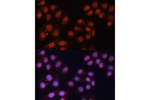 Immunofluorescence analysis of HeLa cells using CDK11B antibody (ABIN6130092, ABIN6138305, ABIN6138306 and ABIN6216598) at dilution of 1:100. (CDK11 Antikörper  (AA 1-130))