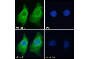 Immunofluorescence (IF) image for anti-Argininosuccinate Synthase 1 (ASS1) (Internal Region) antibody (ABIN190834)