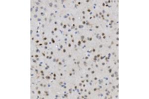 IHC analysis of MBD4/MED1 using anti-MBD4/MED1 antibody (ABIN7600185).