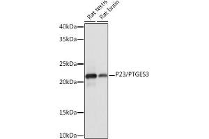 Western blot analysis of extracts of various cell lines, using P23/PTGES3 Rabbit mAb (ABIN1679503, ABIN3019390, ABIN3019391 and ABIN7101767) at 1:1000 dilution.
