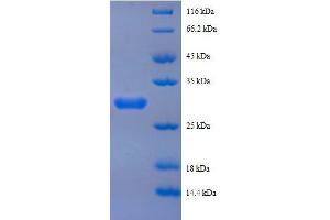 Peptide YY (AA 31-64), (full length) protein (GST tag) (Peptide YY Protein (PYY) (AA 31-64, full length) (GST tag))