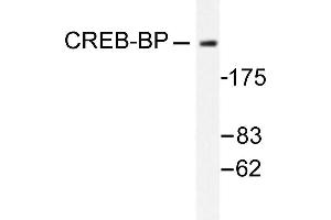 Image no. 1 for anti-CREB Binding Protein (CREBBP) antibody (ABIN265372) (CBP Antikörper)