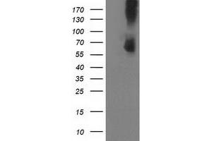 Western Blotting (WB) image for anti-phosphodiesterase 1B, Calmodulin-Dependent (PDE1B) antibody (ABIN1500075)