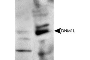Western blot analysis with DNM1L polyclonal antibody  at 1 : 500x dilution. (Dynamin 1-Like Antikörper  (AA 500-600))