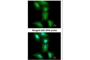 Immunofluorescence (IF) image for anti-Proteasome (Prosome, Macropain) 26S Subunit, ATPase, 5 (PSMC5) (Center) antibody (ABIN2856087)