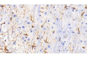 Detection of GFAP in Mouse Spinal cord Tissue using Monoclonal Antibody to Glial Fibrillary Acidic Protein (GFAP) (GFAP Antikörper  (AA 70-374))