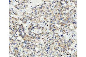 IHC analysis of ABCB4 using anti-ABCB4 antibody (ABIN3043734).