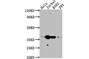 Western Blot Positive WB detected in: Hela whole cell lysate, Jurkat whole cell lysate, K562 whole cell lysate, 293 whole cell lysate All lanes: CDK6 antibody at 1:2000 Secondary Goat polyclonal to rabbit IgG at 1/50000 dilution Predicted band size: 37 kDa Observed band size: 37 kDa (Rekombinanter CDK6 Antikörper)