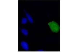 Immunofluorescence (IF) image for anti-Human Papilloma Virus 18 E7 (HPV-18 E7) (AA 1-35), (N-Term) antibody (ABIN781779) (HPV18 E7 Antikörper  (N-Term))