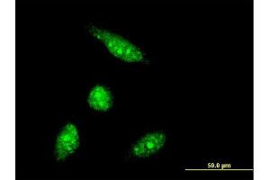 Immunofluorescence of monoclonal antibody to PHF5A on HeLa cell. (PHF5A Antikörper  (AA 1-110))