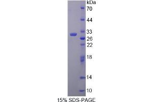 Image no. 1 for Pyruvate Dehydrogenase Complex, Component X (PDHX) (AA 222-471) protein (His tag) (ABIN6238115)