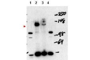 Western blot using  affinity purified anti-NCOA3 antibody shows detection of NCOA3 in mouse liver nuclear extract (lane 1), transient transfected 293 cell lysate (lane 2), HeLa whole cell lysate (lane 3) and mouse thyroid cell nuclear extract (lane 4). (NCOA3 Antikörper)