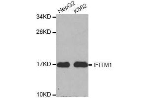 Western blot analysis of extracts of various cell lines, using IFITM1 antibody.