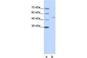 Western Blotting (WB) image for anti-Zinc Finger Protein 555 (ZNF555) antibody (ABIN2461313) (ZNF555 Antikörper)