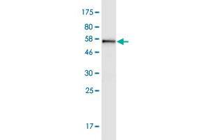 Western Blot detection against Immunogen (59. (TOMM34 Antikörper  (AA 1-309))