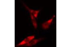 ABIN6266692 staining HeLa cells by IF/ICC. (RANKL Antikörper  (Internal Region))