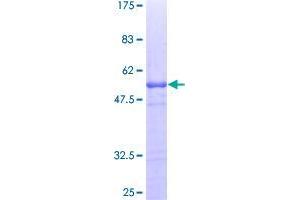 Amyloid beta (A4) Precursor Protein-Binding, Family B, Member 1 Interacting Protein (APBB1IP) (AA 1-172) protein (GST tag)