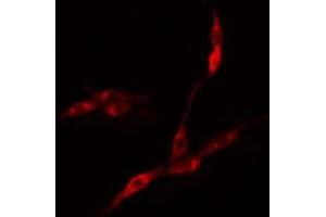 ABIN6275121 staining COLO205 cells by IF/ICC.