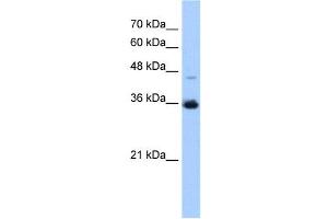 GGPS1 antibody used at 0.