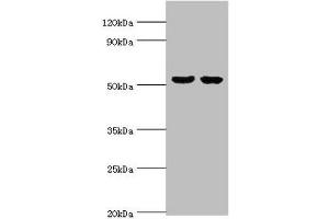 Western blot All lanes: GBA3 antibody at 10 μg/mL Lane 1: Hela whole cell lysate Lane 2: HepG2 whole cell lysate Secondary Goat polyclonal to rabbit IgG at 1/10000 dilution Predicted band size: 54, 19 kDa Observed band size: 54 kDa (GBA3 Antikörper  (AA 1-162))