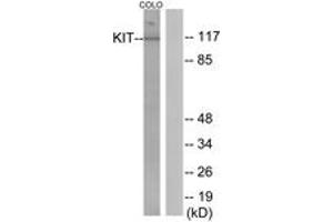 Western blot analysis of extracts from COLO205 cells, using KIT (Ab-936) Antibody. (KIT Antikörper  (AA 906-955))