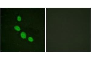 Immunofluorescence analysis of HeLa cells, using C/EBP-epsilon (Ab-74) Antibody. (CEBPE Antikörper  (AA 40-89))