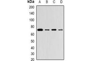Western blot analysis of ZNF145 expression in Hela (A), THP1 (B), mouse lung (C), mouse brain (D) whole cell lysates. (ZBTB16 Antikörper)