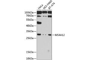 Western blot analysis of extracts of various cell lines, using MS4 antibody (ABIN6131373, ABIN6144052, ABIN6144053 and ABIN6224244) at 1:1000 dilution. (MS4A12 Antikörper  (AA 1-90))